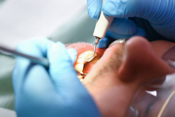 Best Emergency Dentist for Special Needs Patients in Petaluma, CA