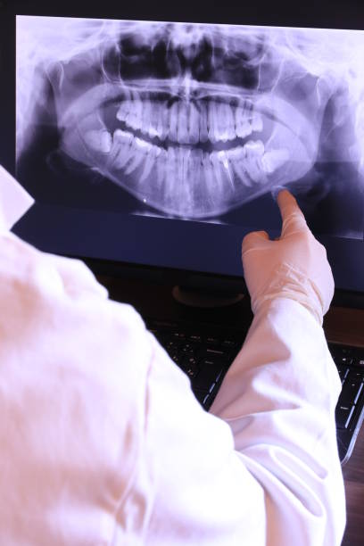 Best Emergency Dental Care for Abscessed Tooth in Petaluma, CA