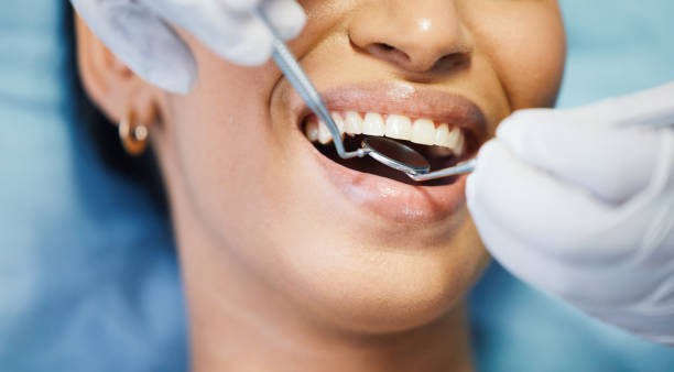 Best Urgent Dental Care for Toothache in Petaluma, CA