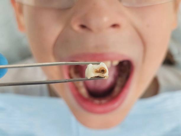 Best Holiday Emergency Dentist in Petaluma, CA
