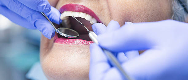 Best Emergency Dental Extractions in Petaluma, CA